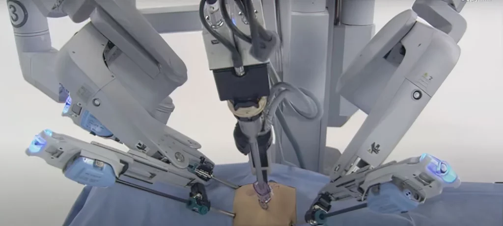 The da Vinci Surgical System used in minimally invasive procedures