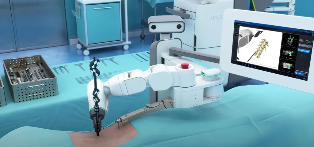 The Mazor X robotic guidance system in surgery.