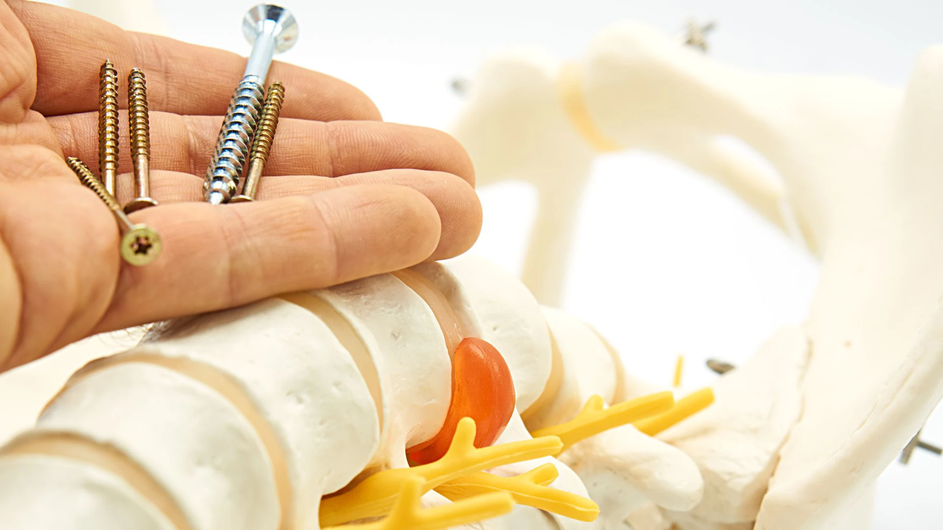 Who is a Candidate for Minimally Invasive Spine Surgery